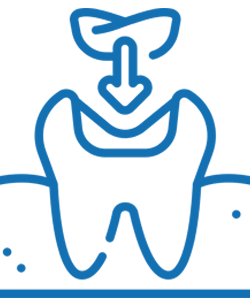 Blue line icon of a tooth with downward arrow showing dental implant procedure and gum line.