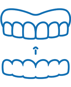 Blue illustration of upper and lower dental arches with arrow indicating bite alignment or occlusion.