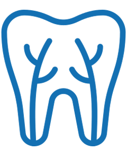 Blue line drawing of tooth showing internal root canal structure for dental treatment.