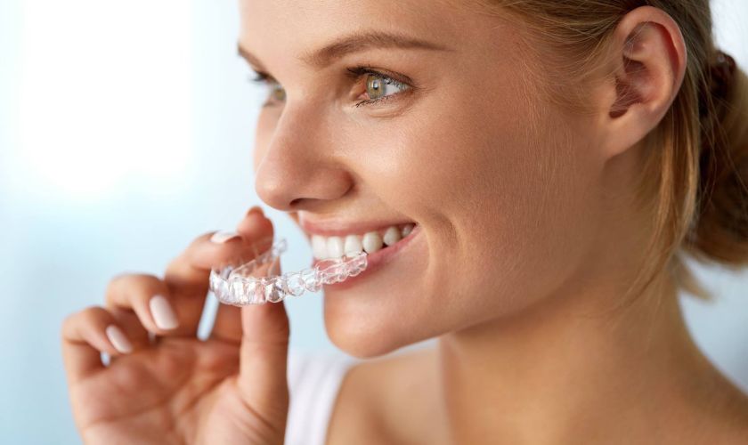Featured image for “Retaining Your Results: The Importance of Invisalign Retainers”