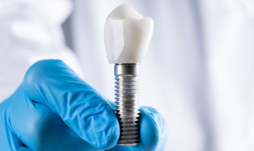 Featured image for “Unveiling the Hidden Perks: How Dental Implants Enhance Oral Health Beyond Aesthetics”